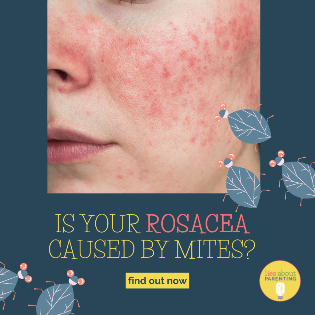 Is Your Rosacea Caused By Mites? +What To Do About It